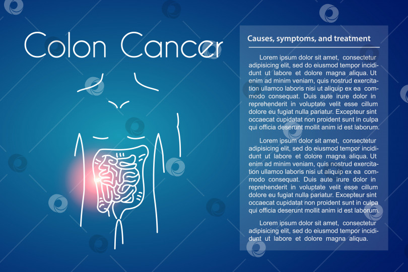 Скачать Векторный рак толстой кишки на синем фоне фотосток Ozero