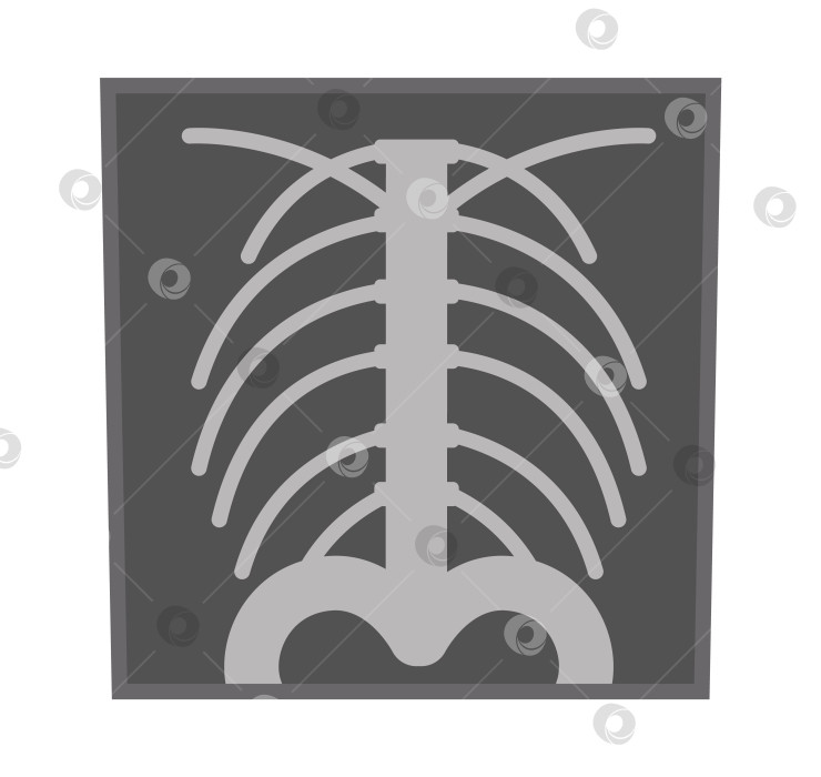 Скачать Векторный плоский значок рентгеновского снимка. Изображение медицинского оборудования, выделенное на белом фоне. Концепция здравоохранения, исследований и лабораторий. Клипарт для проверки состояния здоровья или лечения фотосток Ozero