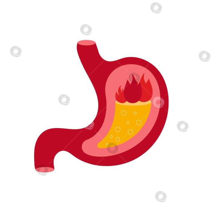 Скачать Иллюстрация сильной боли и изжоги в желудке. фотосток Ozero