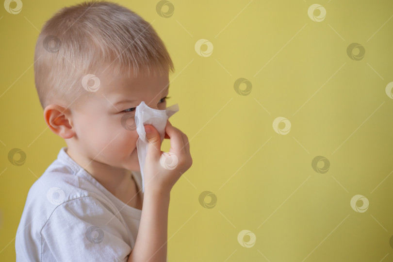 Скачать Ребенок в белой футболке на желтом фоне сморкается. Больной ребенок с салфеткой. Ребенок-аллергик, сезон гриппа. Ребенок с простудным ринитом, простужен. Маленький мальчик с помощью салфетки чистит нос от аллергии и гриппа. Копировальное пространство. фотосток Ozero