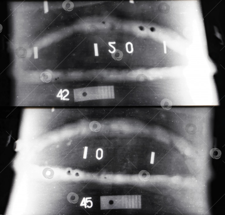 Скачать Рентгеновский снимок сварного шва трубопровода фотосток Ozero