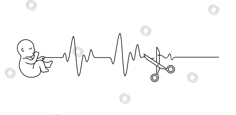 Скачать Плод ребенка с сердцебиением пульсирует, отрезанный ножницами в стиле контура векторной иллюстрации. Понятие выкидыш или аборт фотосток Ozero