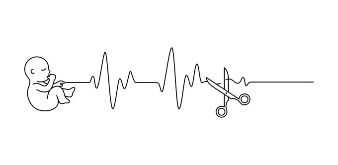 [object Object] undefined