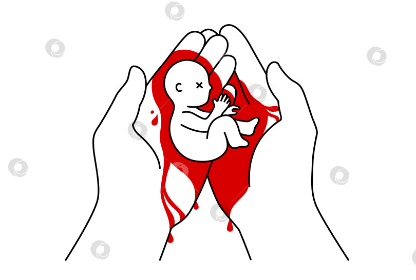 Скачать Две руки, покрытые кровью, держат мертвого ребенка после выкидыша, векторная иллюстрация в стиле контура фотосток Ozero