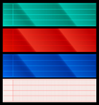 [object Object] undefined