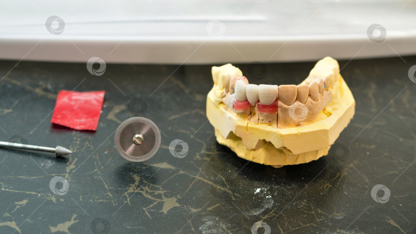 Скачать Изготовление зубных протезов фотосток Ozero