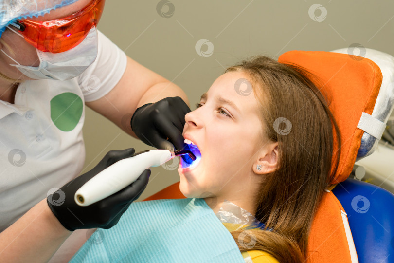 Скачать УФ-лампа для полимеризации зубов в полости рта фотосток Ozero