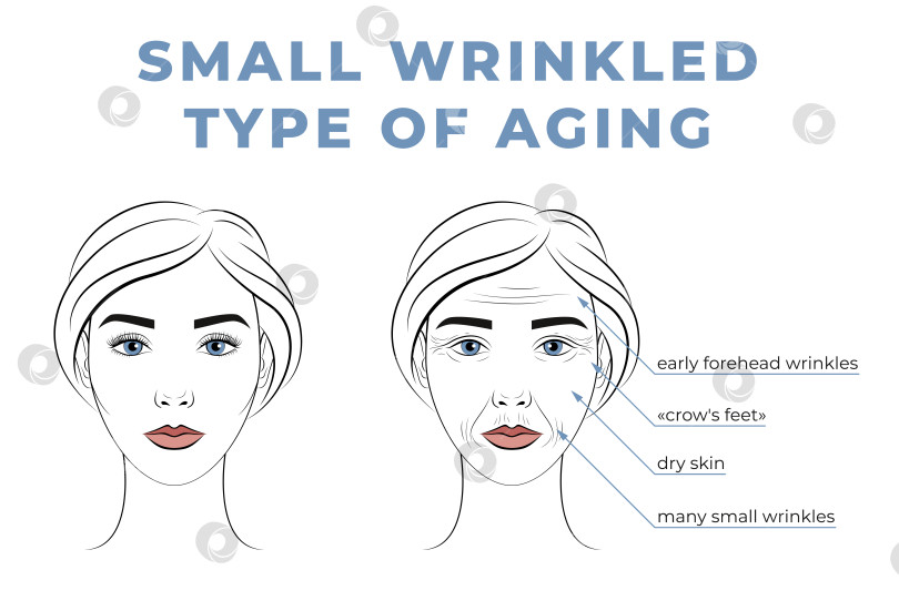 Скачать Небольшие морщинки по типу старения на лице. Лицо женщины в молодости и в старости. фотосток Ozero