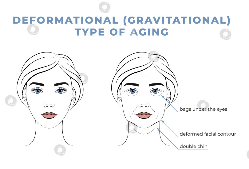 Скачать Деформационный тип старения на лице. Лицо женщины в молодости и в старости. фотосток Ozero