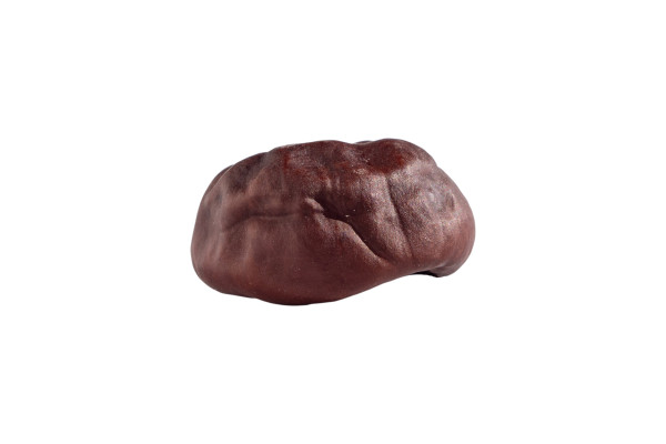 [object Object] undefined