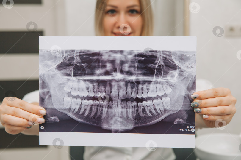 Скачать Терпеливая красивая девушка держит в руках рентгеновский снимок своих зубов. концепция медицины и стоматологии. фотосток Ozero