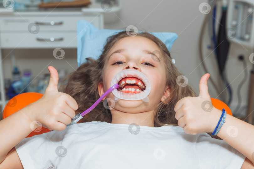 Скачать стоматолог использует резиновую прокладку во время осмотра пациента. маленькая девочка с втягивающим устройством для щеки во рту фотосток Ozero