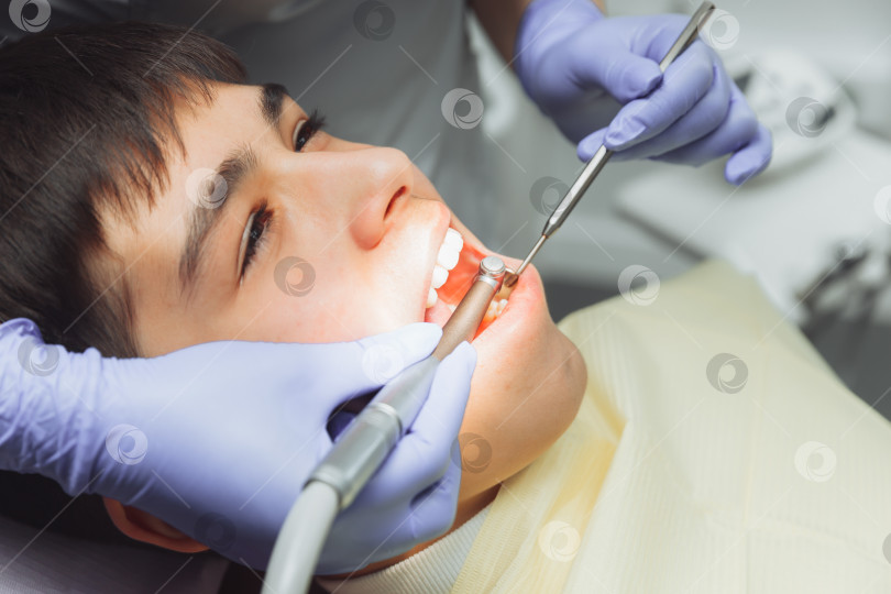 Скачать Сверление зубов и отсасывание слюны с помощью эжектора. стоматолог лечит зубы пациента в современном стоматологическом кабинете. фотосток Ozero