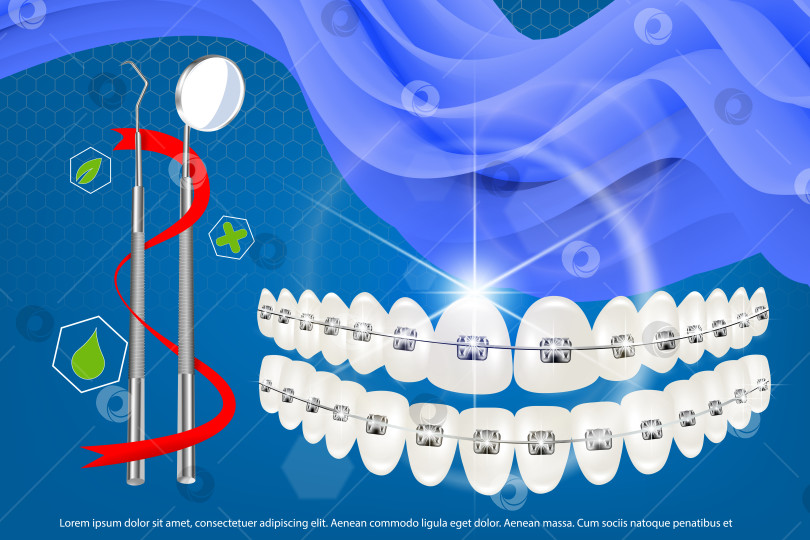 Скачать 3d векторная иллюстрация, реалистичные зубы с брекетами на верхней и нижней челюсти. Выравнивание прикуса зубов, зубных рядов с помощью брекетов, зубных брекет-систем. фотосток Ozero
