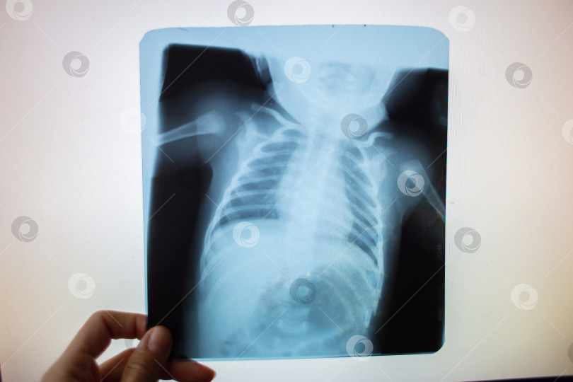 Скачать Рентгеновский снимок органов брюшной полости маленького ребенка в просвете на белом экране. Медицинские приборы фотосток Ozero