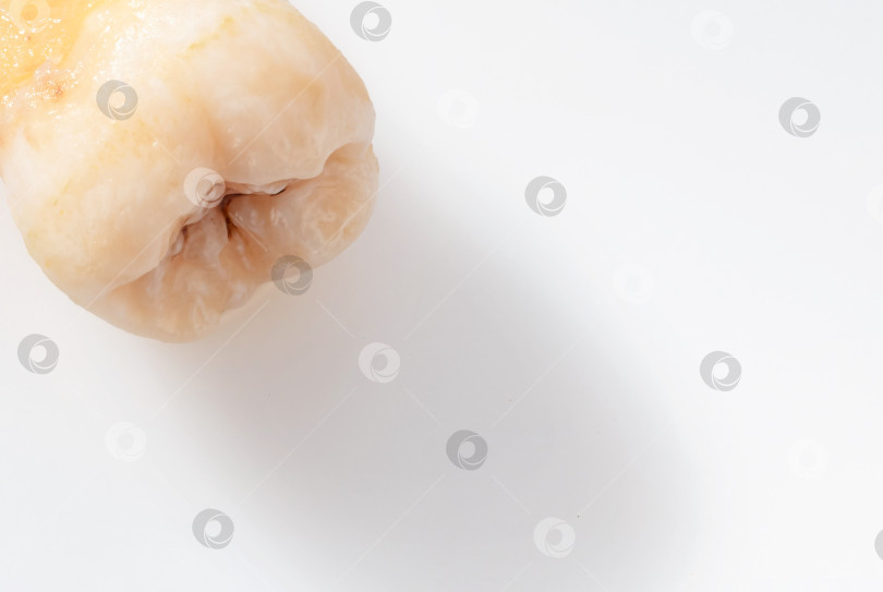 Скачать Удаленный зуб изображен на белом фоне. фотосток Ozero