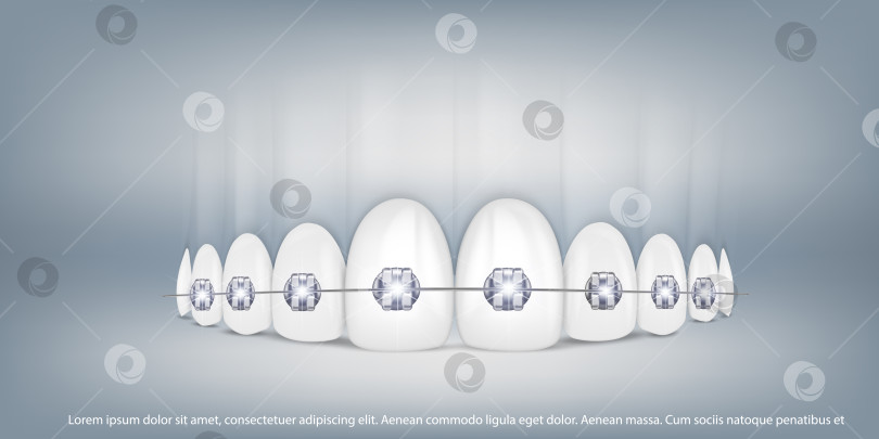 Скачать 3d векторная иллюстрация, реалистичные зубы с брекетами на верхней и нижней челюсти. Выравнивание прикуса зубов, формирование зубного ряда с помощью брекетов, зубных брекет-систем. фотосток Ozero