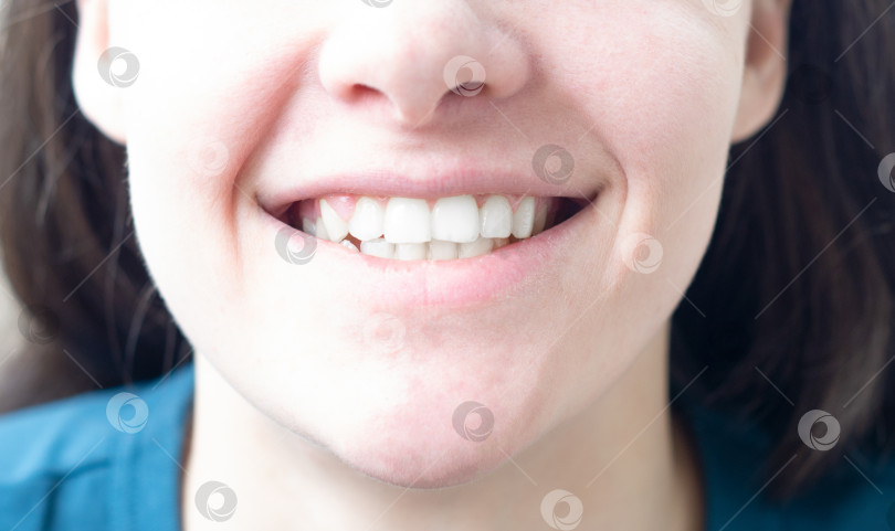Скачать Девушка улыбается. Крупный план женской улыбки с обнаженными зубами. фотосток Ozero