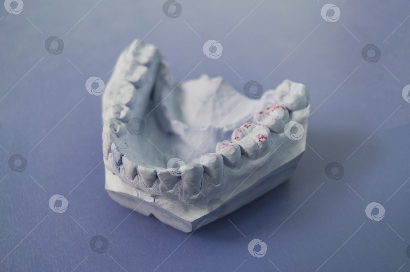Скачать Модель челюстей на столе стоматолога на синем фоне фотосток Ozero