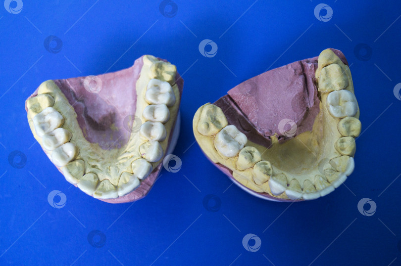 Скачать Модель челюстей на столе стоматолога на синем фоне фотосток Ozero