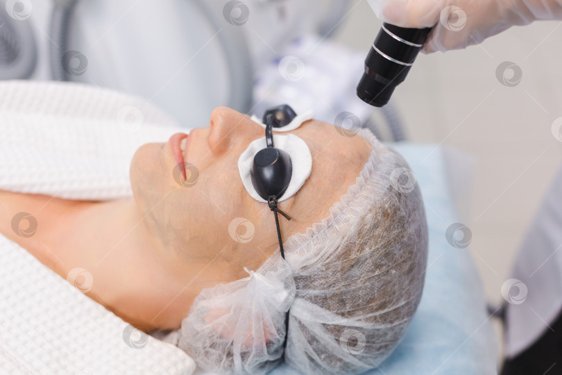 Скачать Фотография лица молодой девушки в защитных очках во время процедуры карбонового пилинга в салоне красоты фотосток Ozero