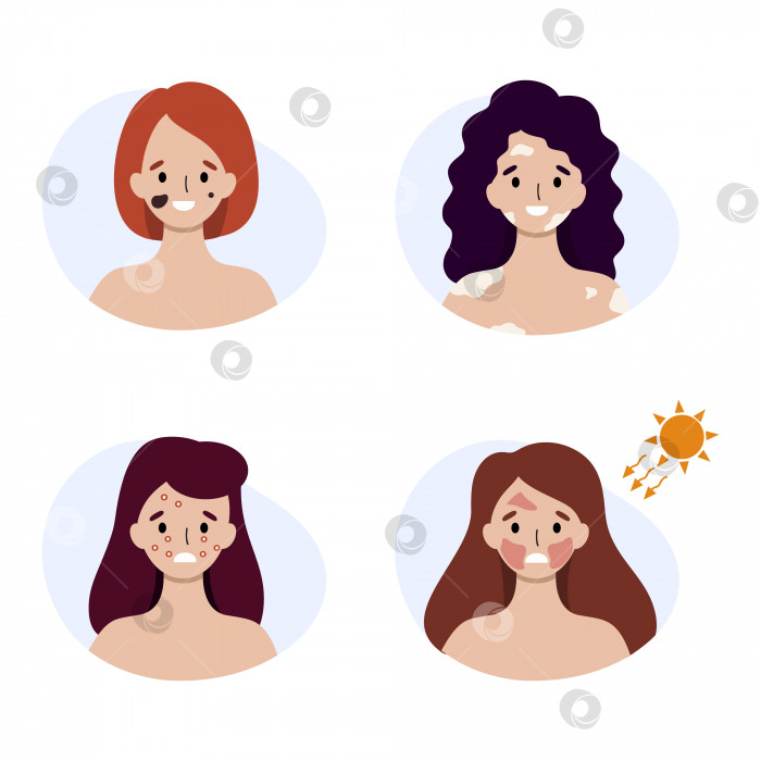 Скачать Женщины с различными кожными заболеваниями. Солнечные ожоги и симптомы аллергии на лице. фотосток Ozero