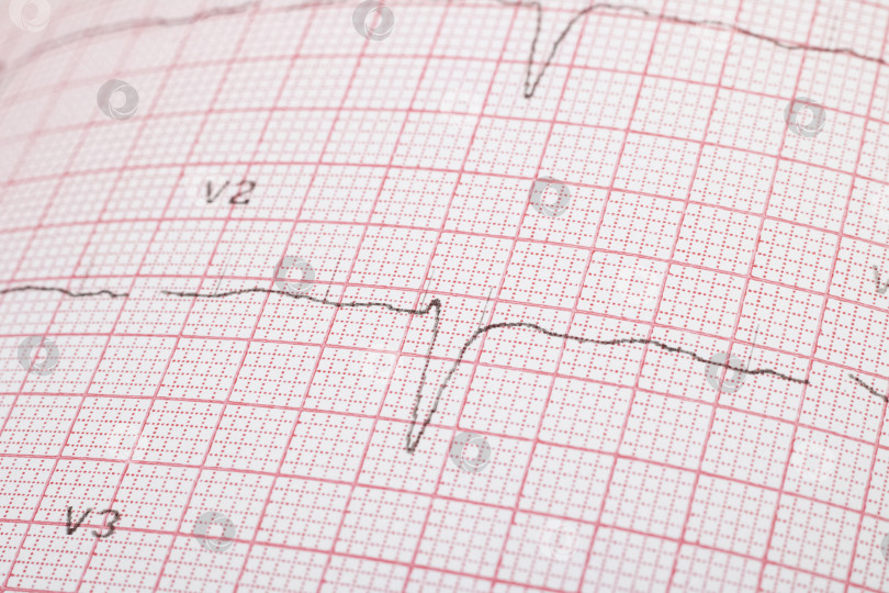 Скачать Линии кардиограммы на розовой бумаге крупным планом фотосток Ozero