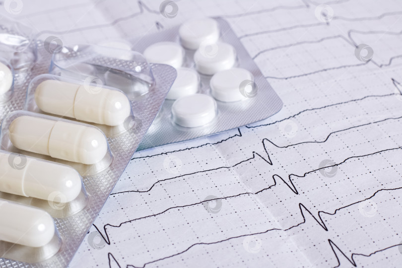 Скачать Результаты кардиограммы на бумаге и в таблетках, здоровье сердца фотосток Ozero