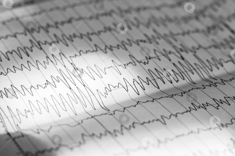 Скачать Результат электроэнцефалограммы на бумаге крупным планом, тест мозговой активности фотосток Ozero