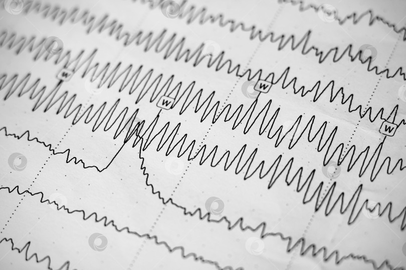 Скачать Результат электроэнцефалограммы на бумаге крупным планом, тест мозговой активности фотосток Ozero