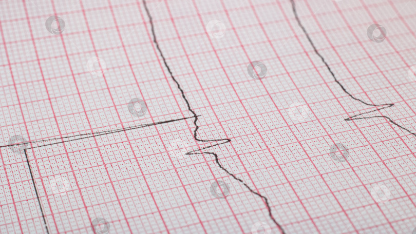 Скачать Линия кардиограммы крупным планом, болезни сердца, макрофотография фотосток Ozero