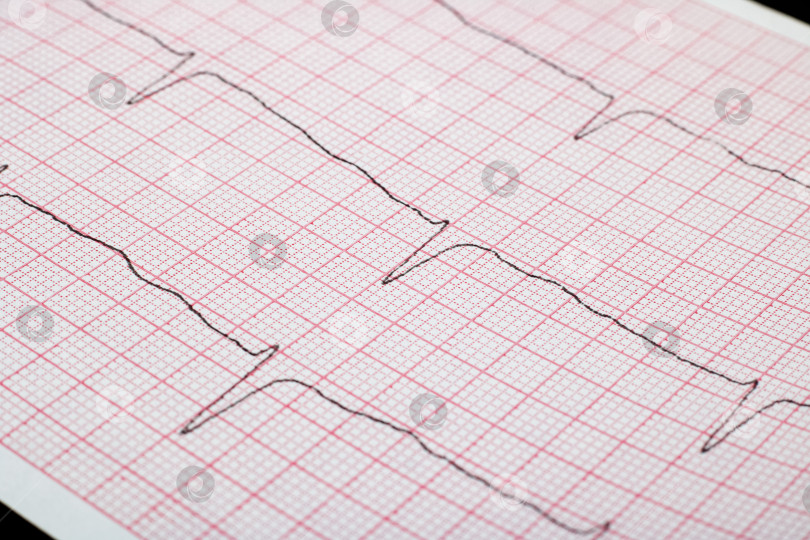 Скачать Линия кардиограммы крупным планом, сердечные заболевания фотосток Ozero