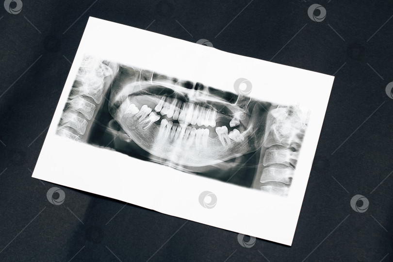 Скачать Панорамное изображение челюсти на черном фоне фотосток Ozero