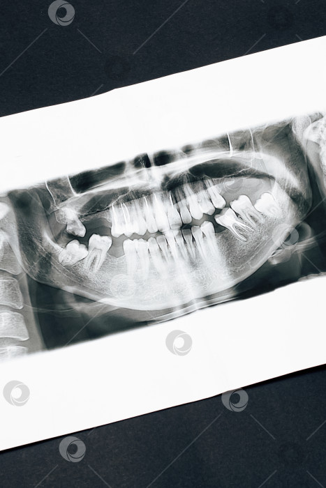 Скачать Панорамное изображение челюсти на черном фоне фотосток Ozero