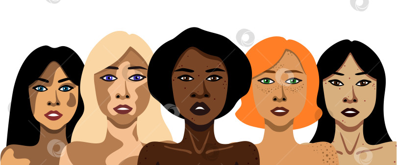 Скачать Различные кожные заболевания у женщин векторная иллюстрация в минималистичном стиле на белом фоне фотосток Ozero