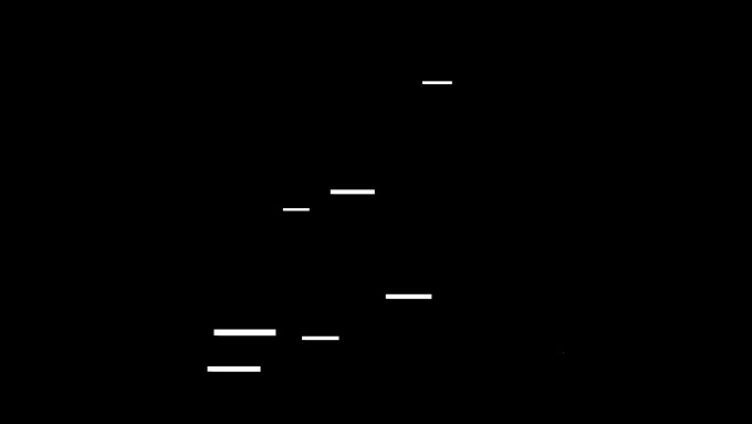 [object Object] undefined