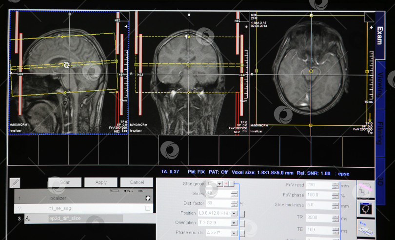 Скачать томографическое сканирование головы фотосток Ozero
