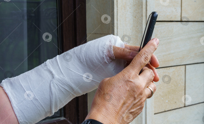 Скачать Женская рука в белой гипсовой повязке держит мобильный телефон фотосток Ozero