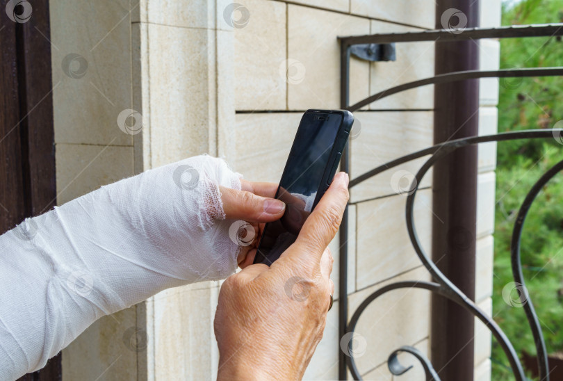 Скачать Женская рука в белой гипсовой повязке держит мобильный телефон фотосток Ozero