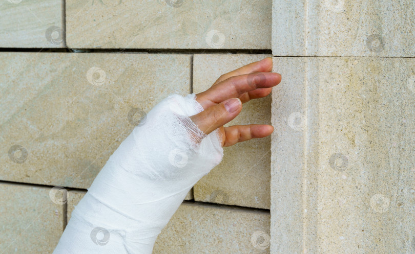 Скачать Женская рука в белом гипсовом слепке на фоне светло-песчаной стены фотосток Ozero