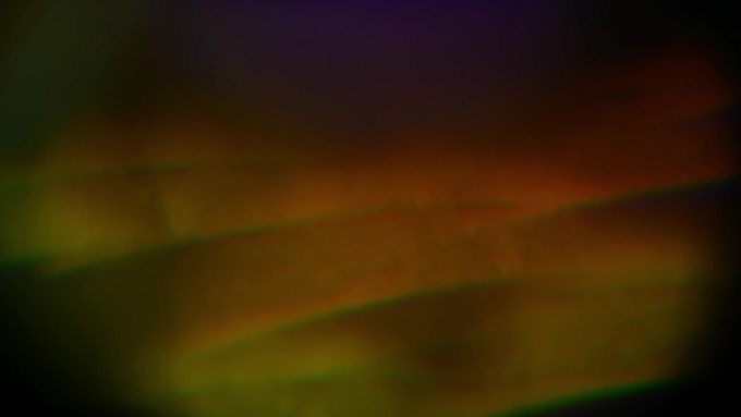[object Object] undefined