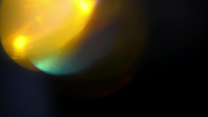 [object Object] undefined