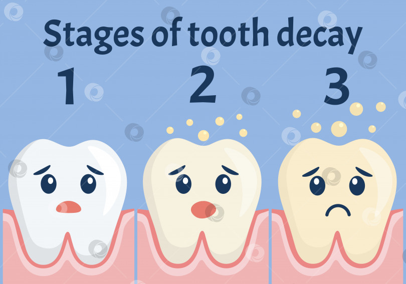 Скачать Этапы развития кариеса. Плоский дизайн. Симпатичные зубы с лицами. фотосток Ozero