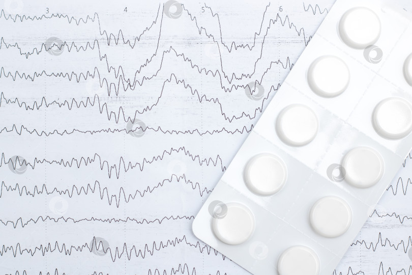 Скачать График электроэнцефалограммы крупным планом на бумаге, диагностика эпилепсии фотосток Ozero
