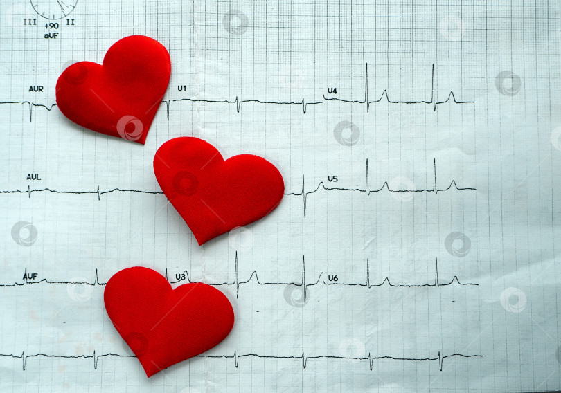 Скачать Три сердца расположены вертикально на фоне электрокардиограммы. Горизонтальная медицинская справка с результатами обследования сердца. фотосток Ozero