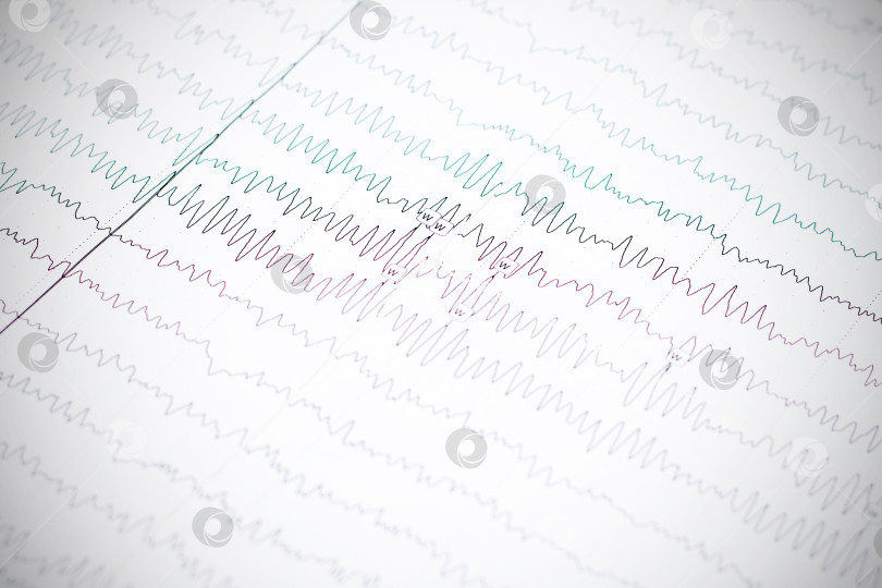 Скачать График электроэнцефалограммы крупным планом на бумаге, диагностика эпилепсии фотосток Ozero