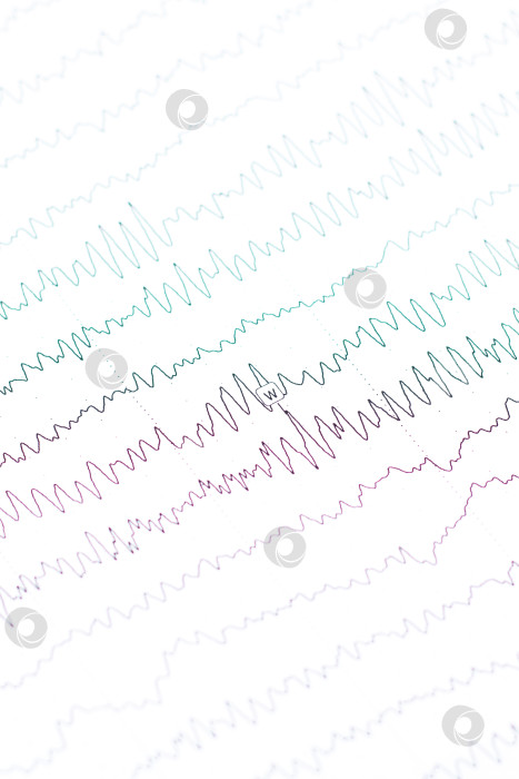 Скачать График электроэнцефалограммы крупным планом на бумаге, диагностика эпилепсии фотосток Ozero