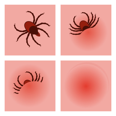 [object Object] undefined