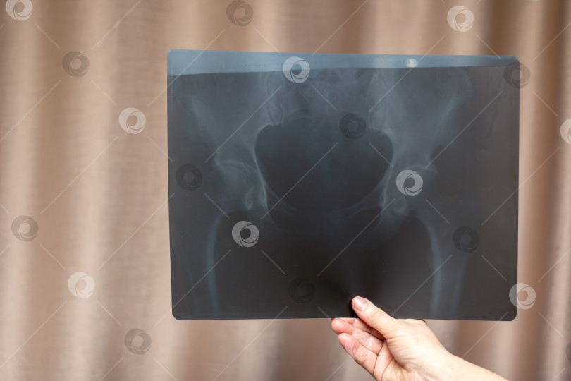 Скачать человек держит в руках рентгеновский снимок своего таза фотосток Ozero