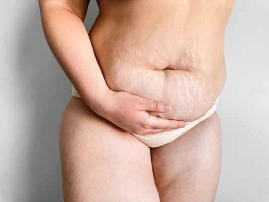 [object Object] undefined